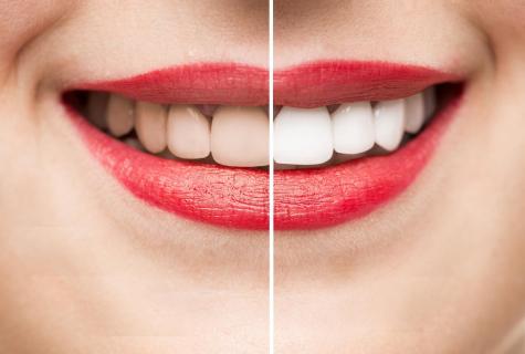 How to achieve whiteness of teeth